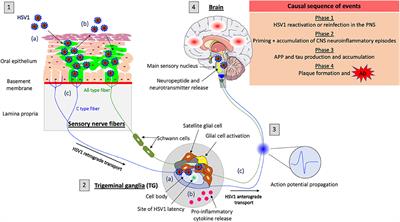 The Potential Role of Herpes Simplex Virus Type 1 and Neuroinflammation in the Pathogenesis of Alzheimer's Disease